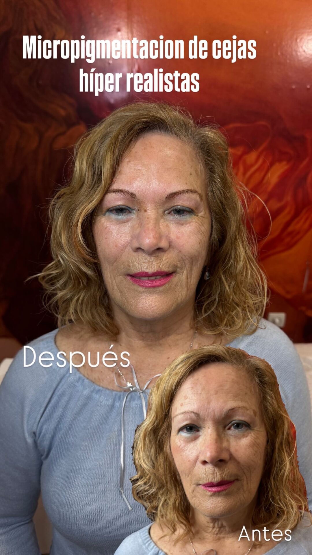 Tratamiento facial
