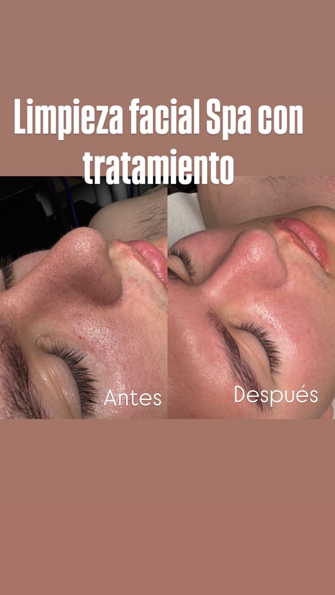 Limpieza facial Spa con tratamiento