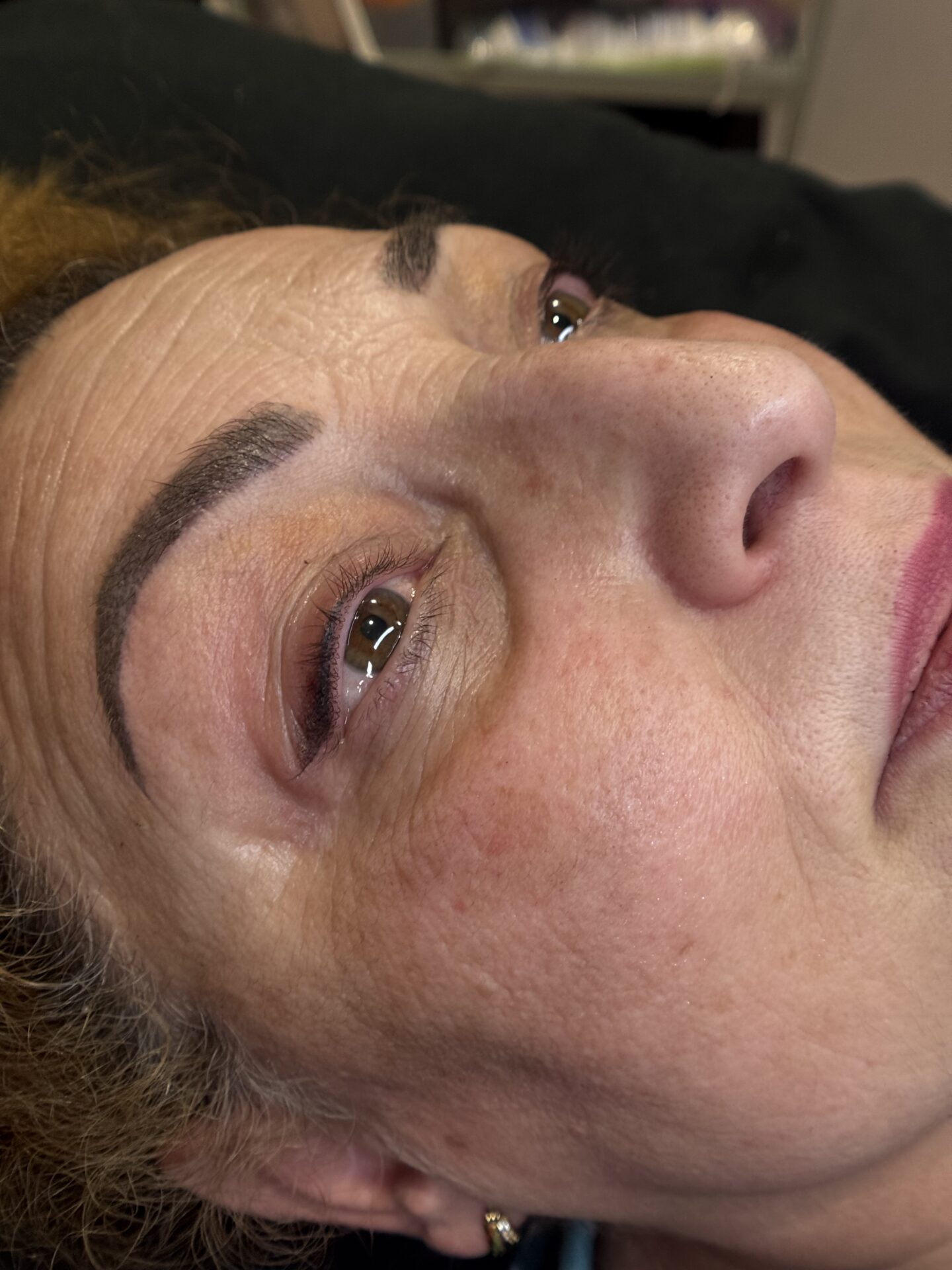 Tratamiento facial