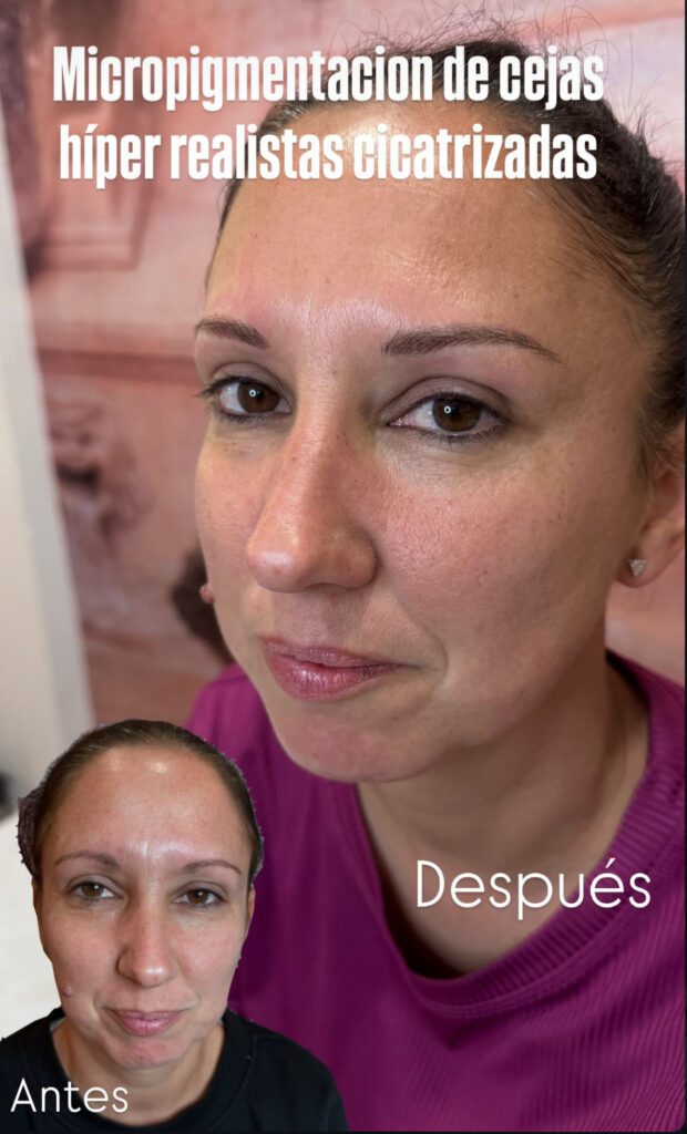 Tratamiento facial