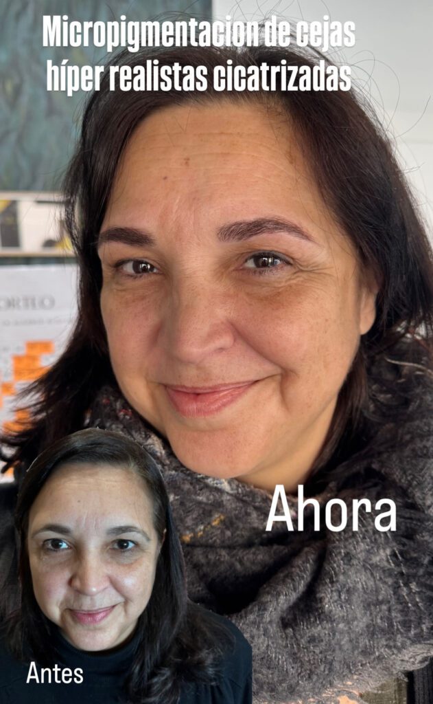 Tratamiento facial
