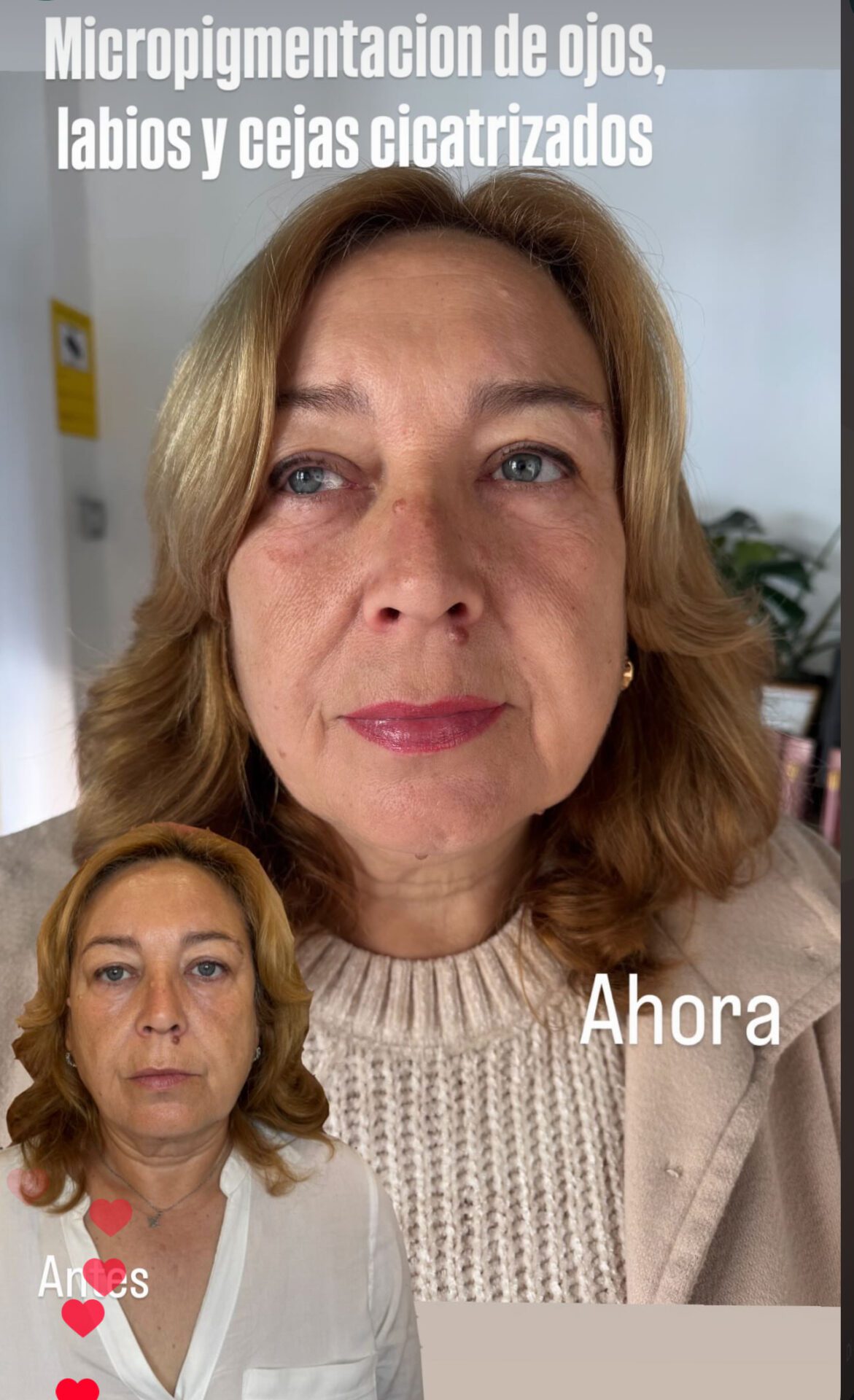 Tratamiento facial
