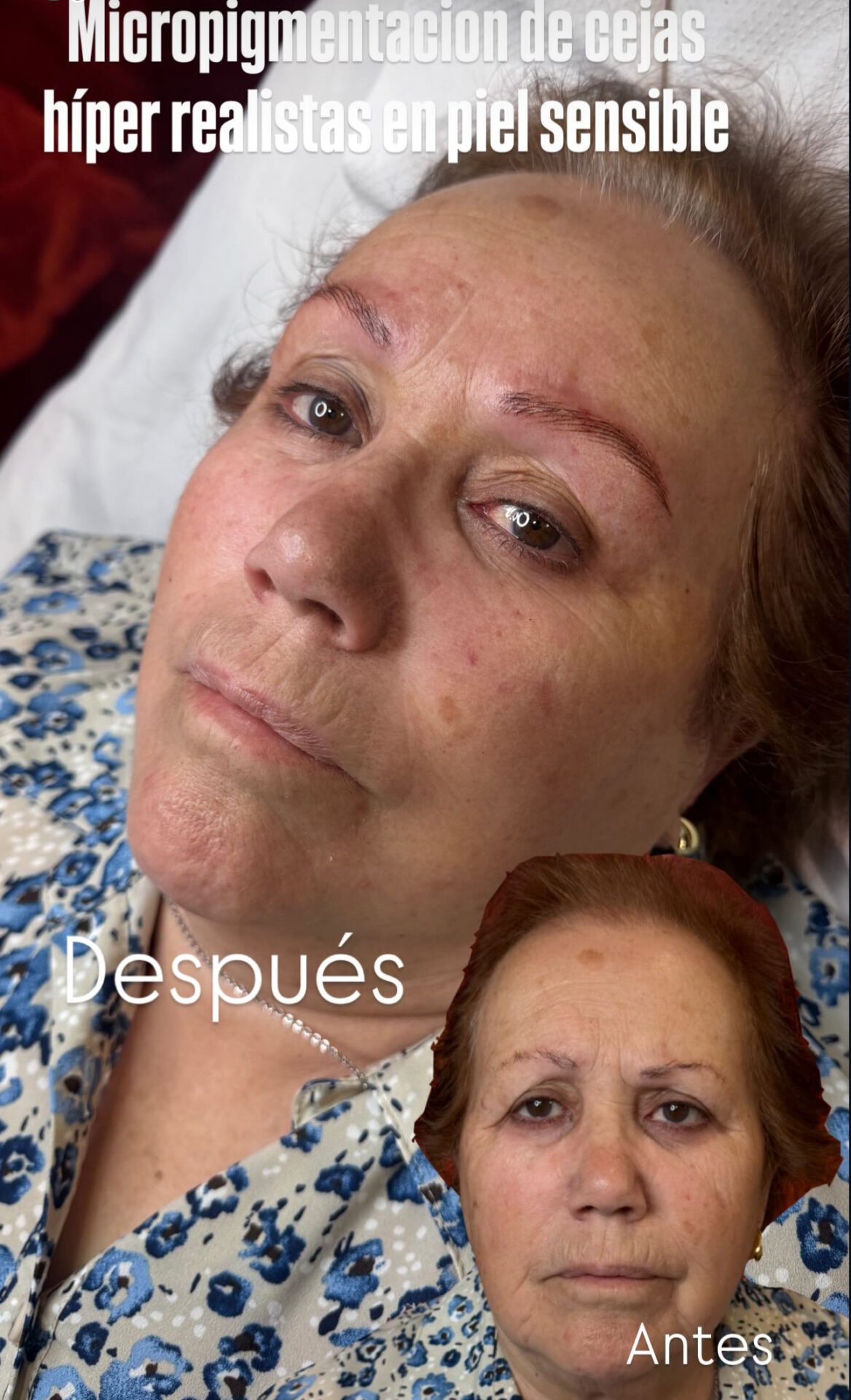 Tratamiento facial
