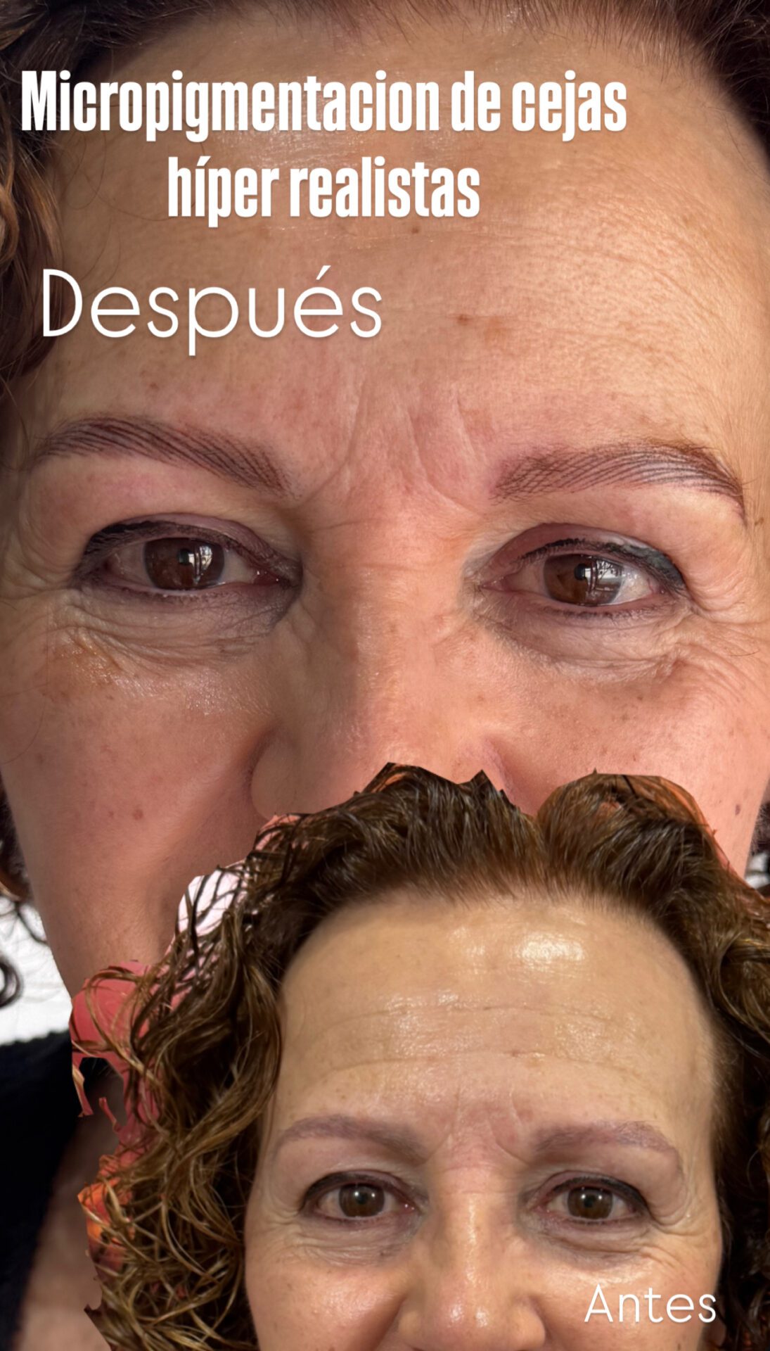 Tratamiento facial