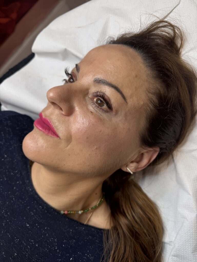 Tratamiento facial